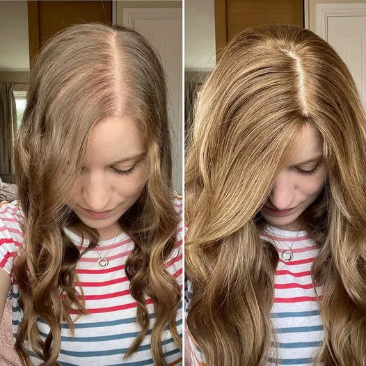 Vera cliente Folixir: cuoio capelluto e densità dei capelli prima e dopo un uso costante