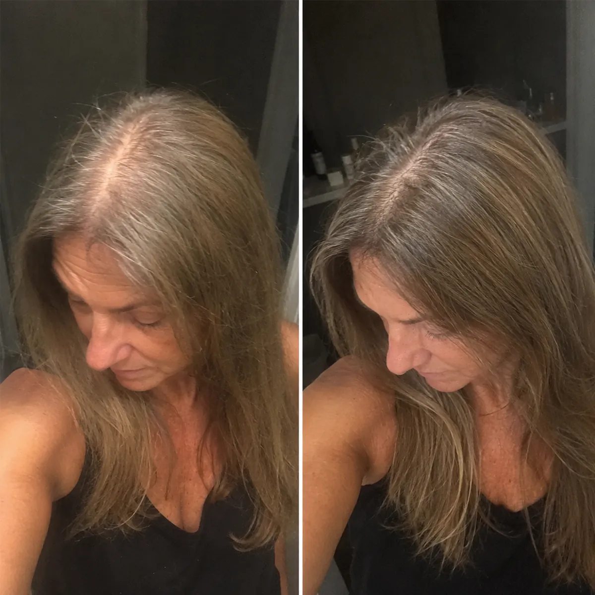 Vera cliente Folixir: riga più larga e cuoio capelluto visibile, prima e dopo un uso costante