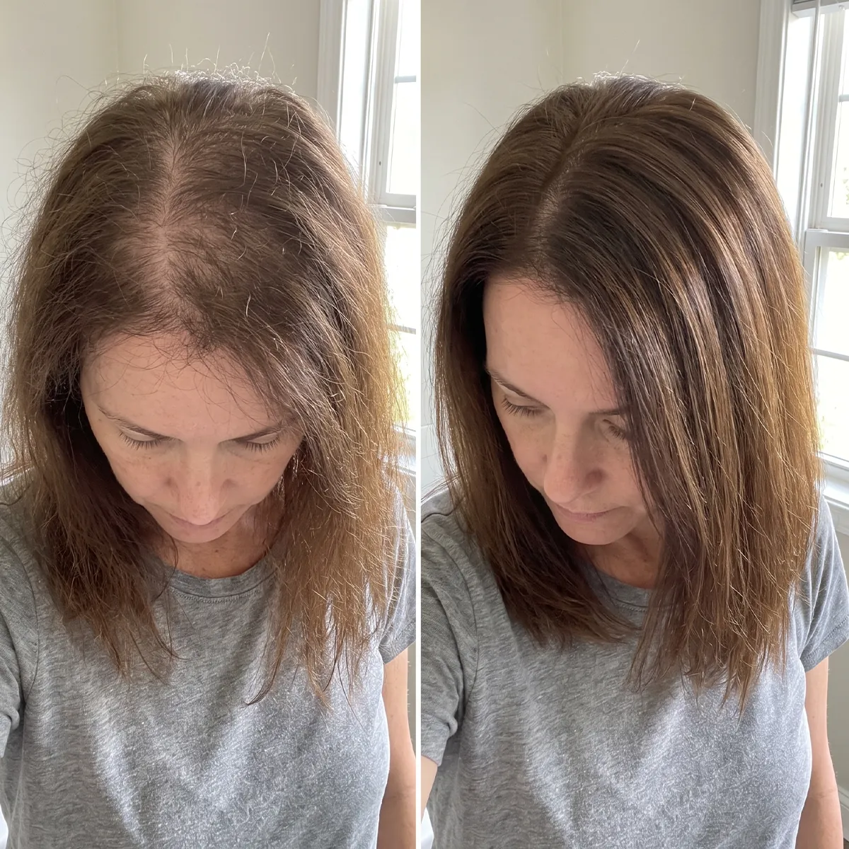 Vera cliente Folixir, 40–50 anni: riga e sommità del capo prima e dopo un uso costante