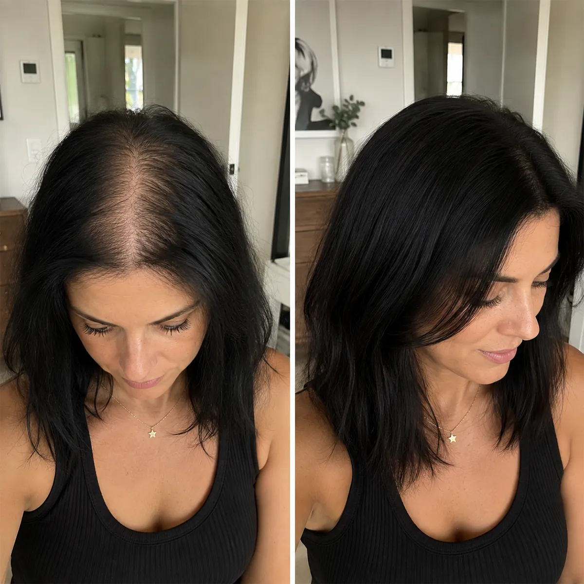 Vera cliente Folixir, 30–40 anni: riga e visibilità del cuoio capelluto prima e dopo un uso costante